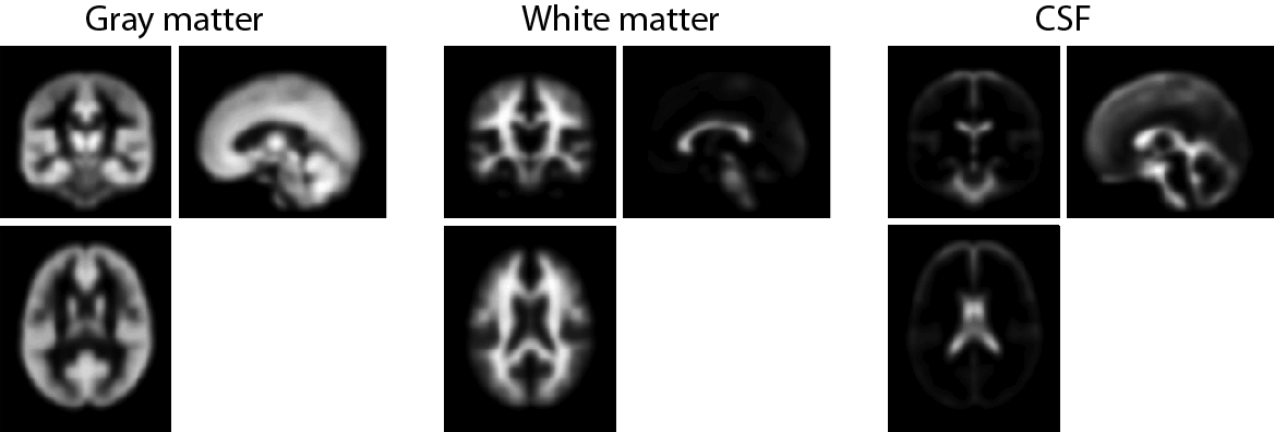 Tissue probability maps for GM, WM, and CSF.