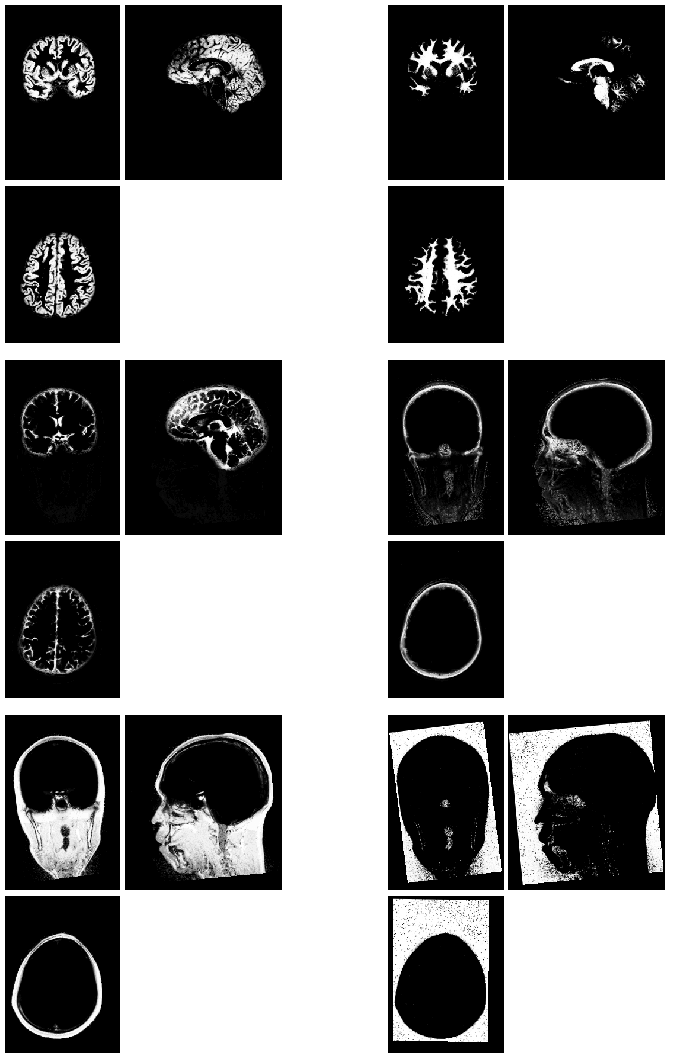 Output volumes from SPM's new segmentation routine.