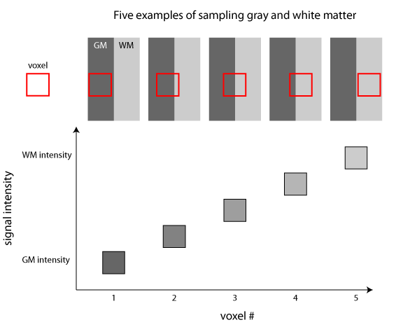 Illustration of partial volume effects when sampling structural MRI images